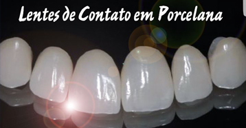 Lentes de Contato de Porcelana